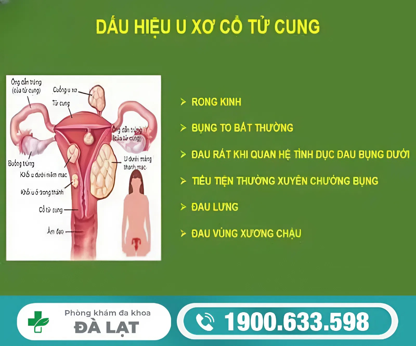 Hình ảnh minh họa